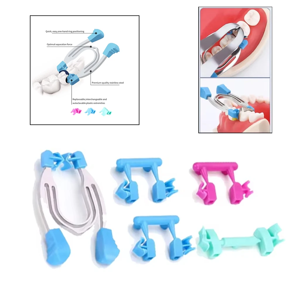 Dental Matrix System Kit - Metal Sectional Contoured Matrices Clamps Wedges & Spring Clip Rings for Molar Restoration