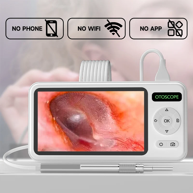 หน้าจอ 5 นิ้วดิจิตอล Otoscope กล้อง HD1080P 3.9 มม.หู Picker 6 LEDs EAR WAX Removal เครื่องมือทําความสะอาดหูสําหรับเด็กผู้ใหญ่