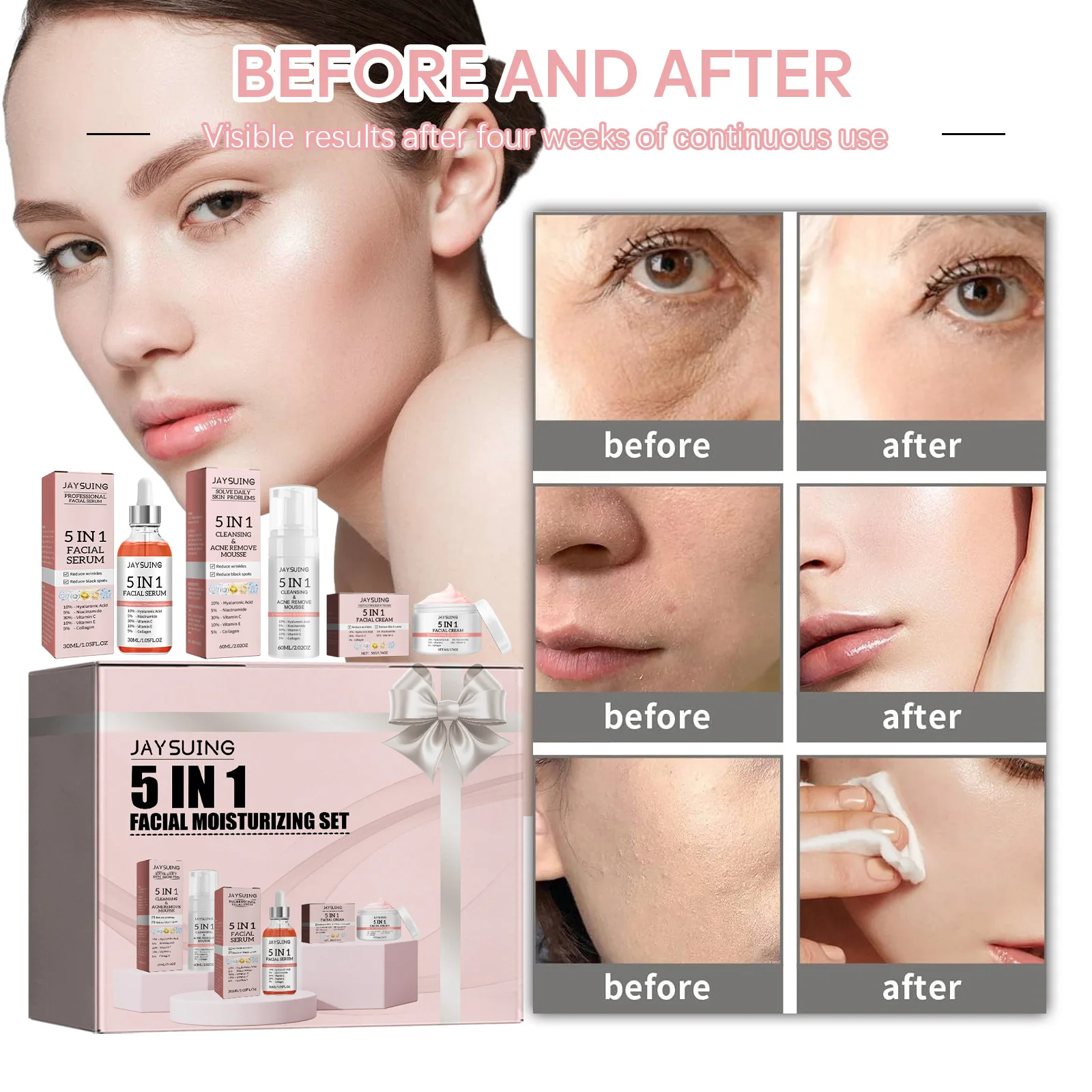 5-in-1 Facial Moisturizing Set Hyaluronic Acid Serum Improve Dullness Reduce Acne Brighten Tighten Skin Nourish Face Cream Kit