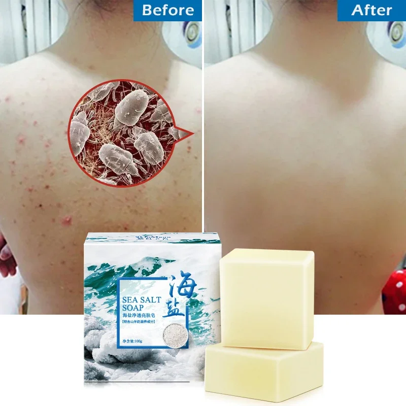 Sea Salt Soap Whitening Moisturizing Wash Base Removal Pimple Pores Acne Treatment Face Care Wash Basis Soap Shower