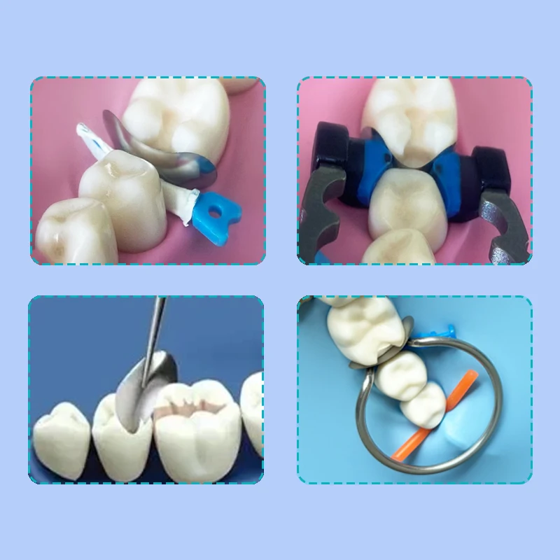 50Pcs Dental Matrix Bands Sectional Contoured Matrix System Metal Matrices Matrix Clamp Ring For Teeth Replacement Dentist Tools view 5
