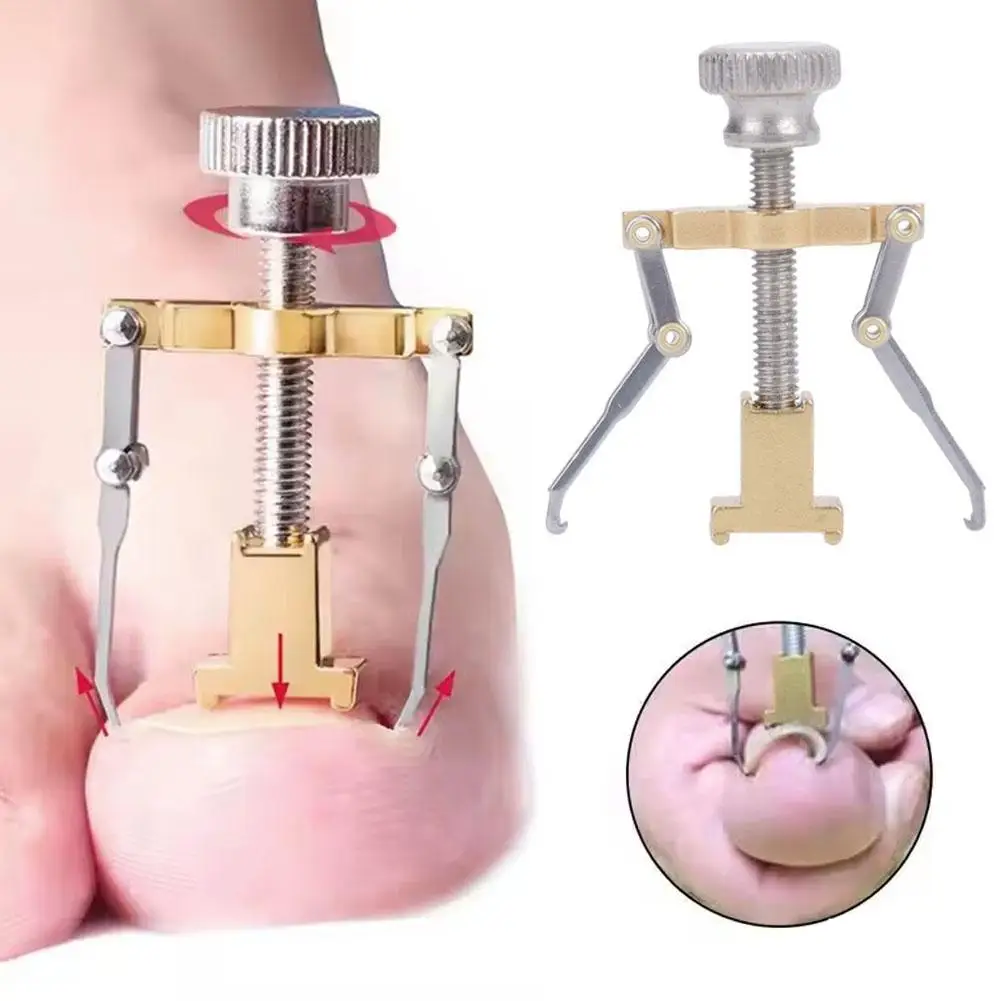 Corretor de unha encravada, clipe de alisamento, tratamento de pedicure, ferramentas de aço, correção de pedicure, cuidados com onyxis, mancha de pé d3u6