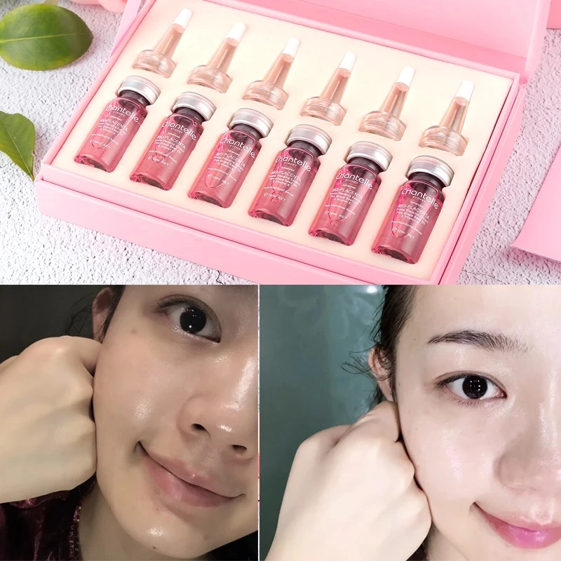 6ชิ้น/ขวด austria Chantelle Sheep placenta ขนาด10มล. ช่วยให้ผิวกระชับอ่อนเยาว์มีสุขภาพดี