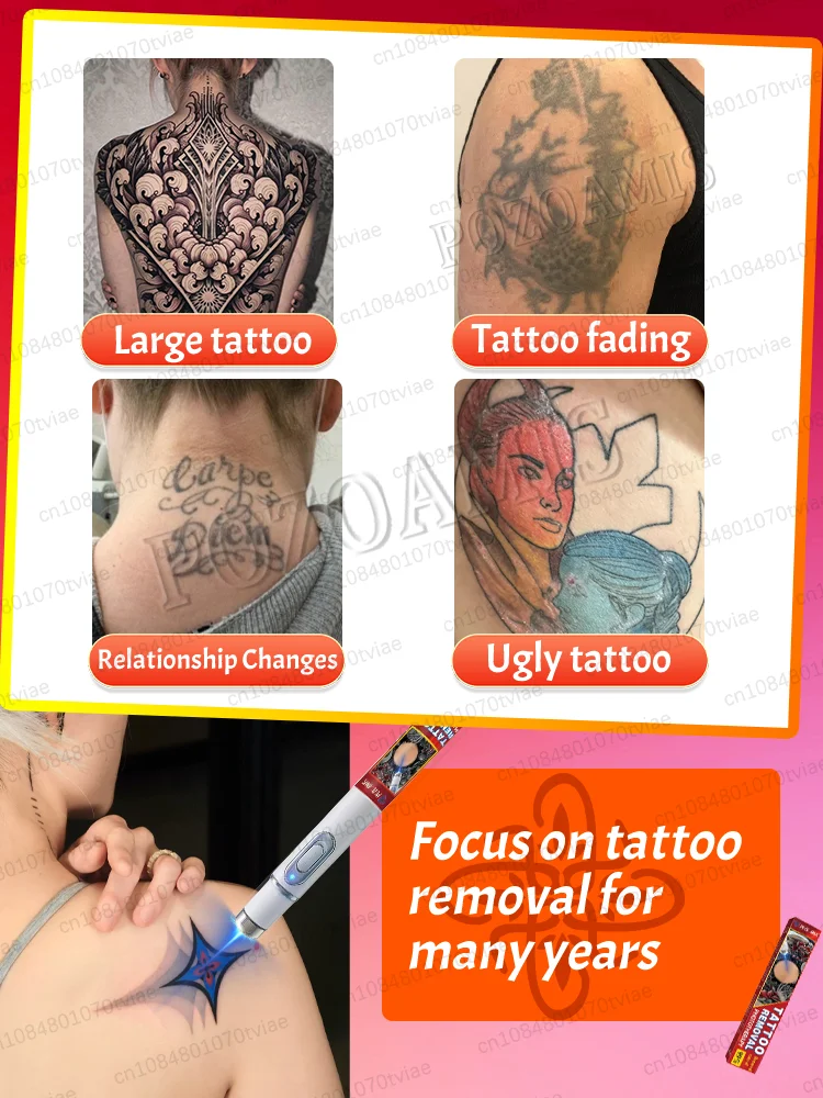 Deep cleaning of tattoos, decomposition of pigmentation, tattoo disappearance