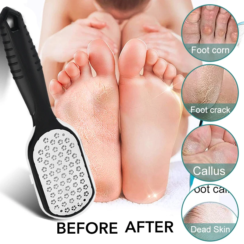 1 Pcs Professional Stainless Steel Callus Remover Foot File Scraper Pedicure Tools Dead Skin Remove for Heels Feet Care Products