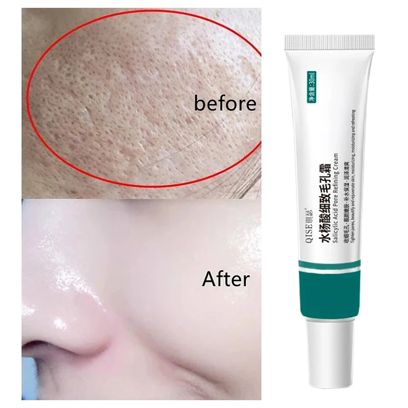 Salicylic Acid Pore Shrinking Cream Quick Elimination Large Pores Remove Blackehead Tighten Face Smooth Skin Care Product