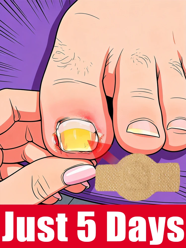 

99% безопасно, попрощайтесь с неприятными оттенками и начните выглядеть чисто и безупречно. ХИТ!