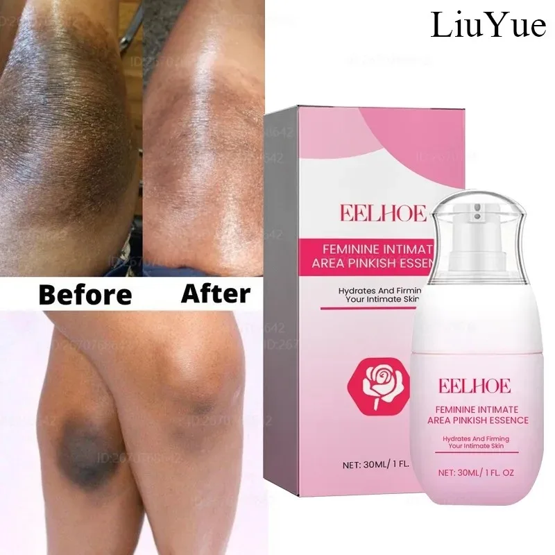 Brightening Care Essence Bleaching Neck Armpits Knees Elbows Moisturizing Repair Elastic and Smooth Skin Lightening Body Care