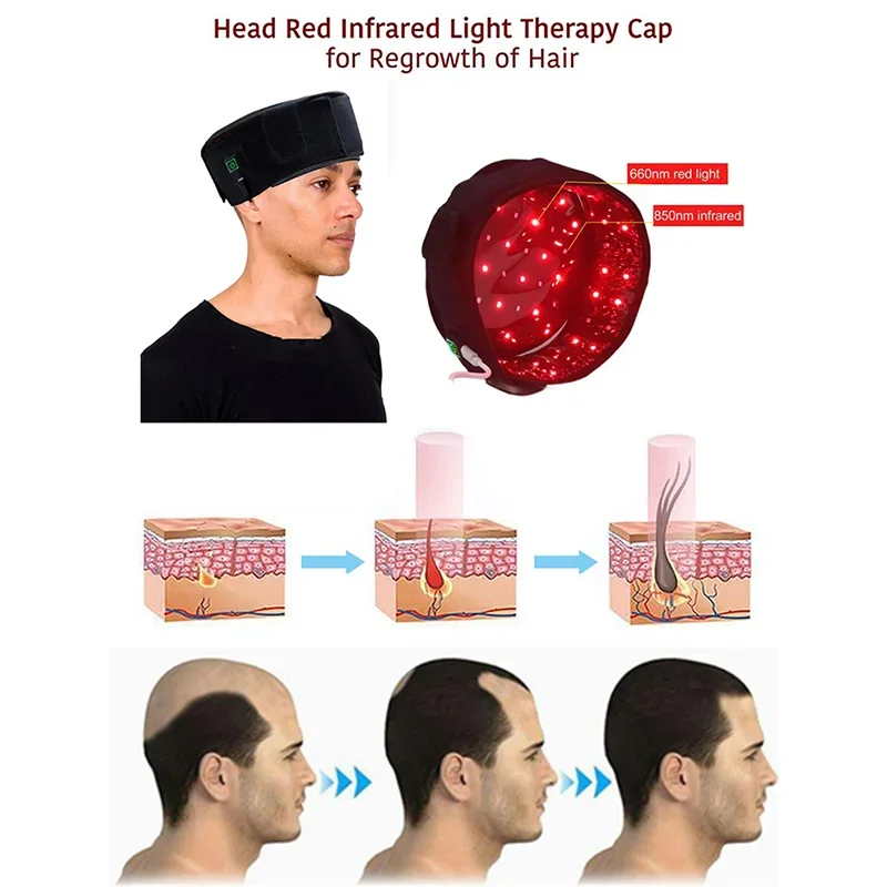 髪の治療のための赤外線放射療法キャップ,sebordic,alopecia,areata,髪の成長,帽子のデバイス,70個