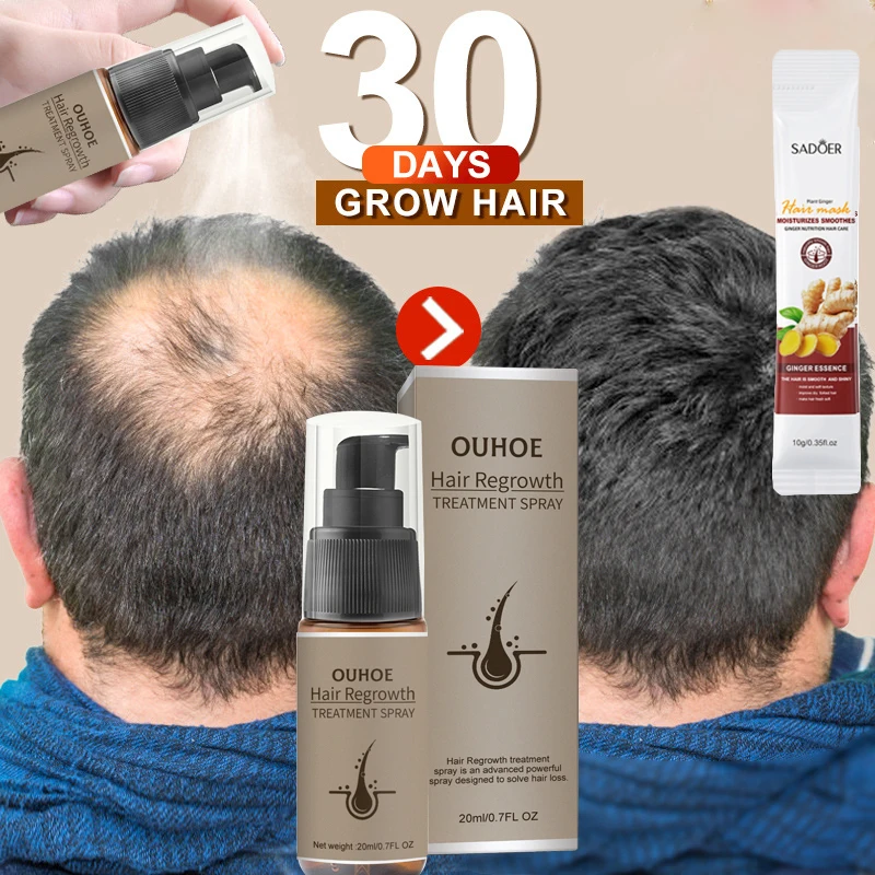 Produtos De Spray De Crescimento Rápido Do Cabelo, Anti Soro De Perda De Cabelo, Evitar A Calvície, Tratamento Do Couro Cabeleireiro, Óleo Essencial Danificado A Seco, Beleza