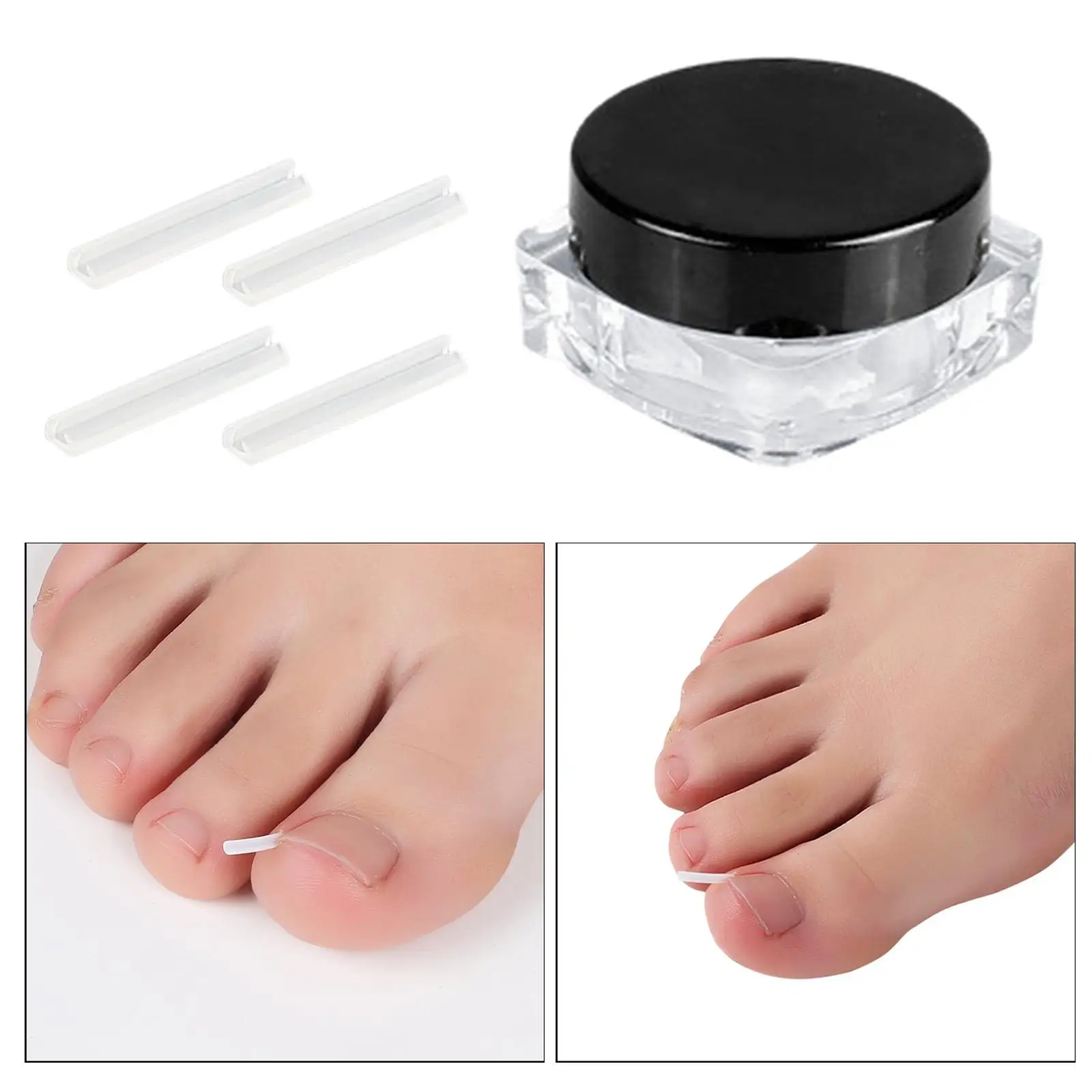 Werkzeug zur Korrektur eingewachsener Zehennägel, Zehennagelbehandlung, Fuß- und Zehenreiniger, Pediküre