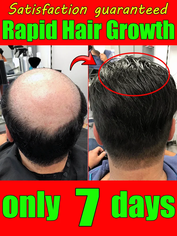

98% of buyers buy again, have more and more hair, say goodbye to baldness, thick hair,Hot selling product