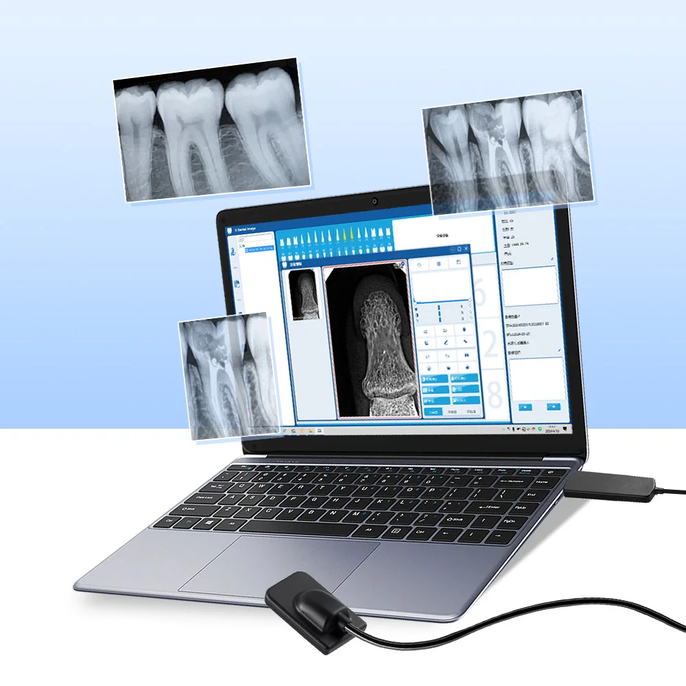 Newest Azdent Dental X-Ray Digital Sensor  Intraoral Digital System HD Image  Dental Laboratory Equipment