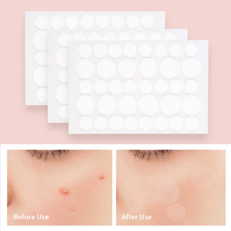 Acne Pimple Patch Adesivos, Pimple Remover Ferramenta, Absorver Pus e Óleo