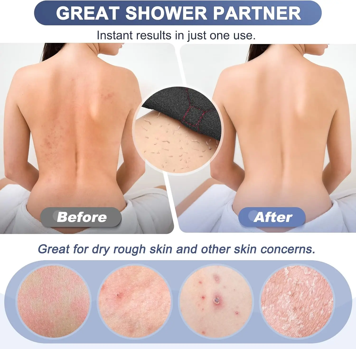 Exfoliating Back Scrubber Towl for Shower Double-Sided Back Scrub Washcloth with Handles Bath Tool for Men Women Skin Care