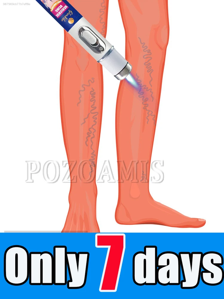 

Nano laser pen improves legs, feet, and thighs
