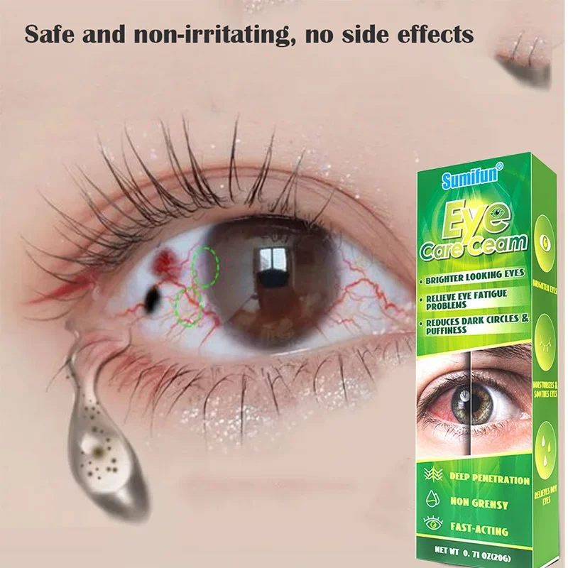 Chinese Herbal Medicine Eye Care Cream Brighter Looking Eyes Relieve Eye Fatigue Problems Reduces Dark Circles And Puffiness