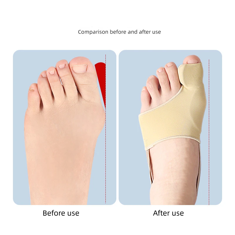 4pieces=2pairs Forefoot Socks Toe Overlapping Separators Adjuster Straightener Orthotics Hallux Valgus Sleeve Bunion Corrector