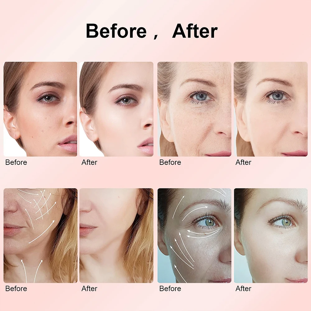 4 في 1 EMS RF LED آلة شد الجلد تنطبق على مدلك الوجه مكافحة الشيخوخة شد الوجه الرعاية المهنية مكافحة الشيخوخة آلة