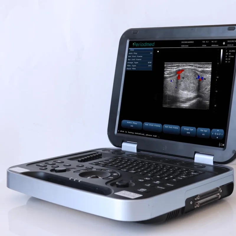 Portable Touchscreen Connectivity Durable Waterproof Multi Mode Image Storage High Resolution Veterinary Ultrasound