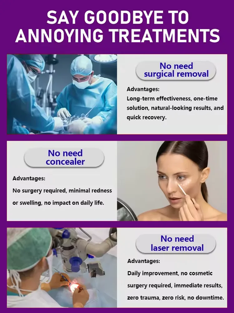 Massage solves various problems Eye care tools