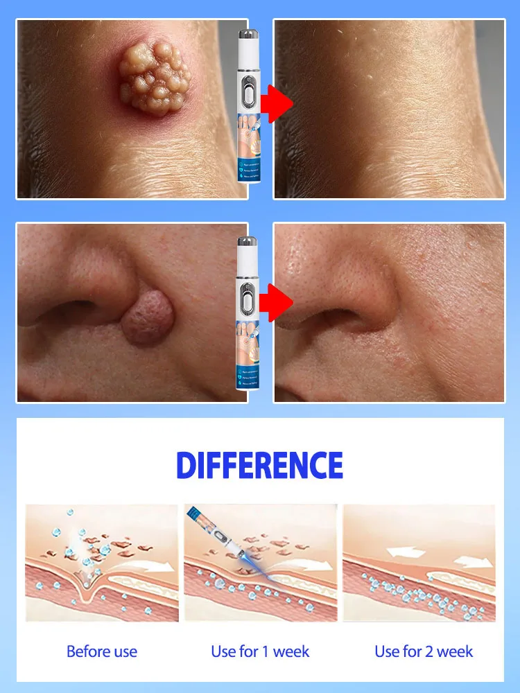 rozwiąż problemy z skórą w ciągu 7 dni