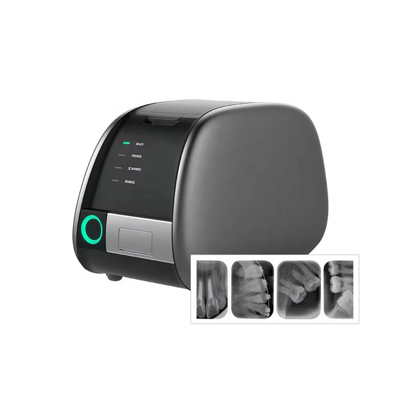 Digital Intraoral P…