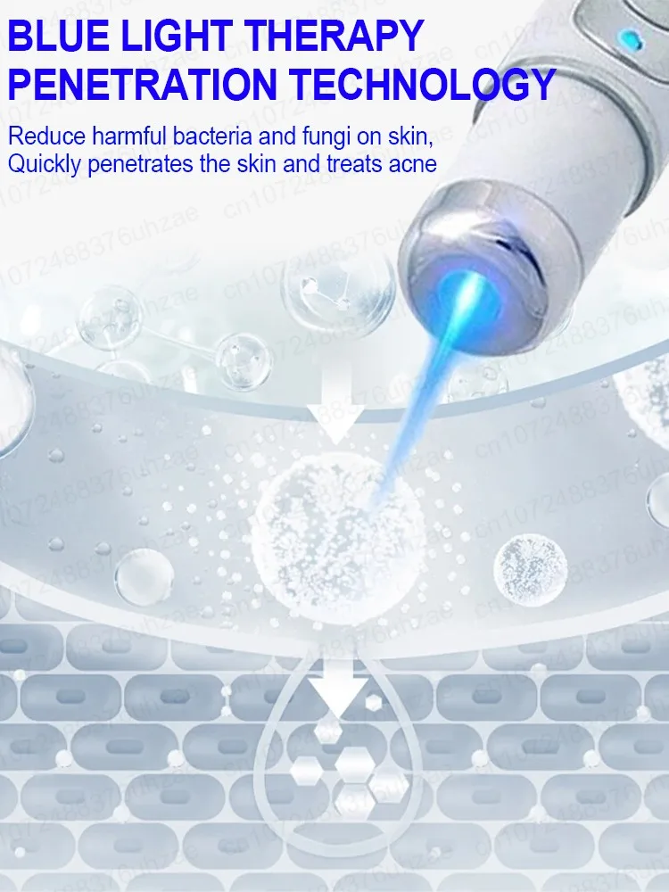 The laser pointer quickly removes acne. Eliminates acne on the face