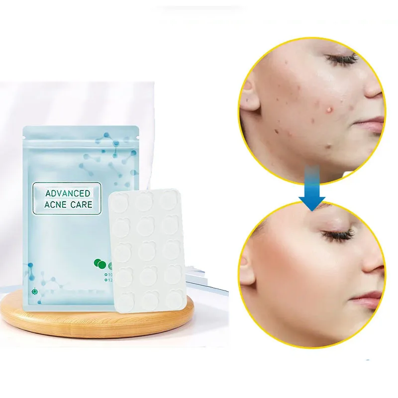 45Pcs Hydrocolloid Acne Patches Invisible Day & Night Use Waterproof Breathable Acne Stickers Pimple Cover Patch