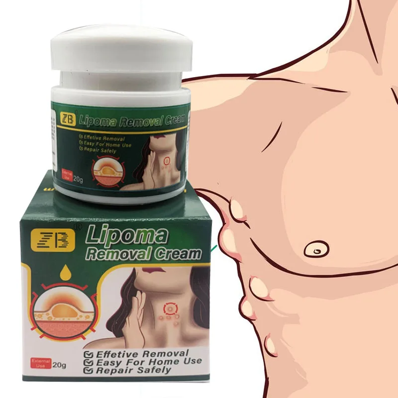 

20g Herb Lipoma Removal Cream Effectively Removes Subcutaneous Lipoma Lumps Relief Pain Relief Inflammation Body Health Cream