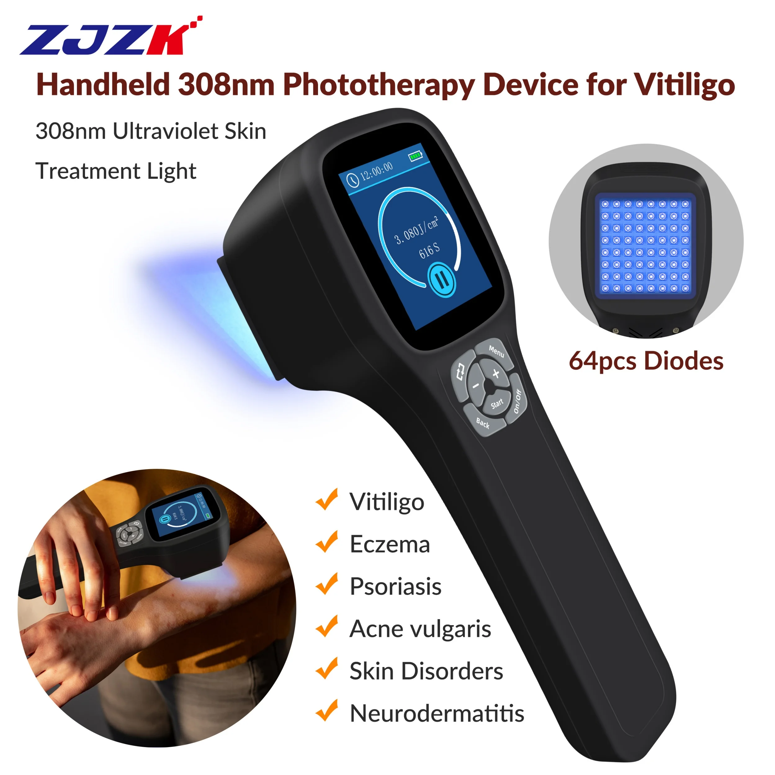 In stock 2026 308 nm Excimer UVB Facial Psoriasis Ultraviolet UV Light Laser Phototherapy Home Therapy System Is Used to Treat L