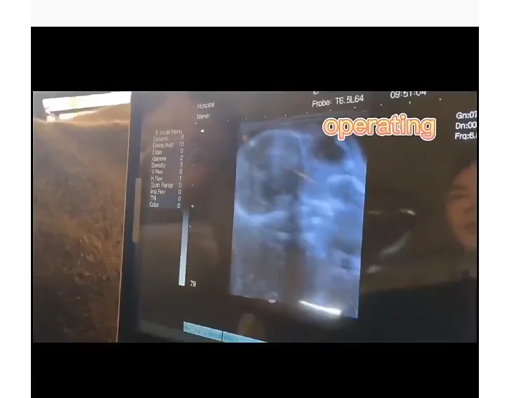 New Arrival High Quality Medical Equipment Veterinary Professional Healthcare Imaging Instruments    Machine For