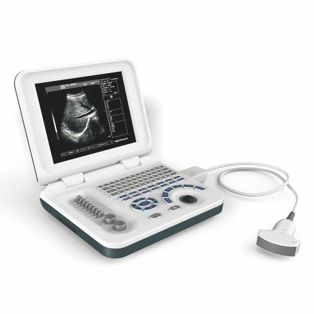 

10 Inch Full Digital LED Laptop Ultrasound Scanner Diagnostic System with 3.5 MHz Convex Probe