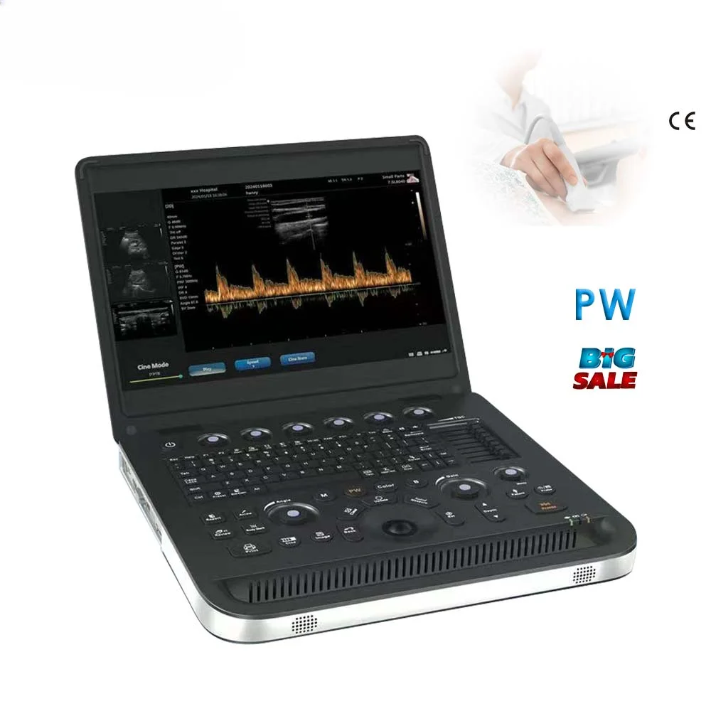 Medical use low price manufacture price SUN-800C portable 3D ultrasound machine