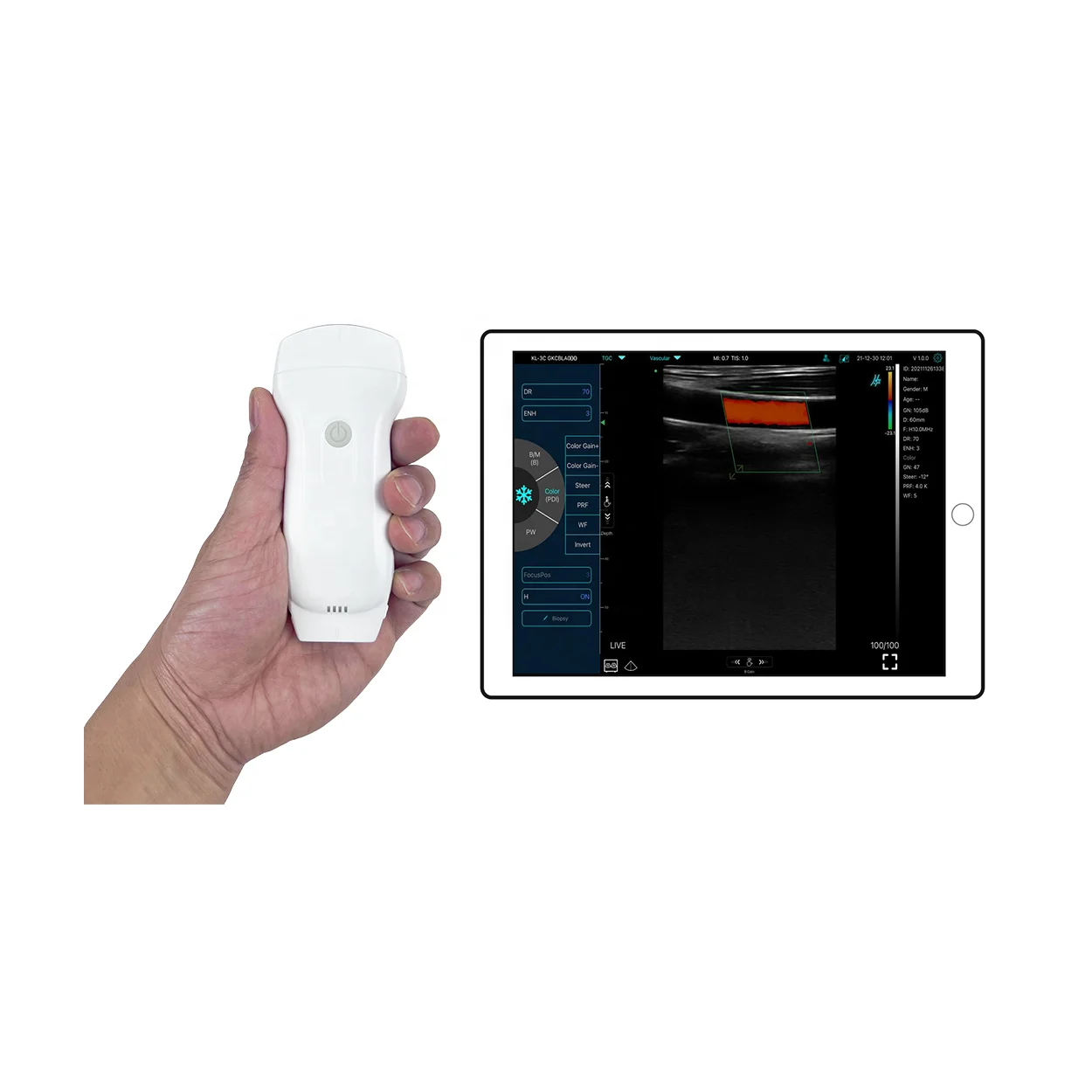Dual-Head Portable Handheld Ultrasound Device, WiFi Wireless Pocket-Sized Medical Ultrasound Instrument