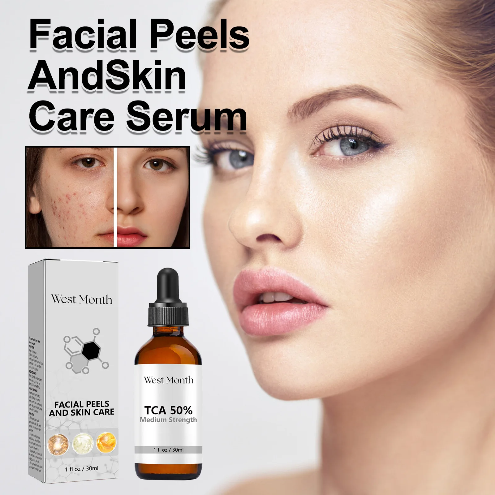 Acne Treatment Serum Remove Dead Skin Fade Pimples Spots Improve Dullness Repairing Whitening Facial Exfoliating Peeling Essence