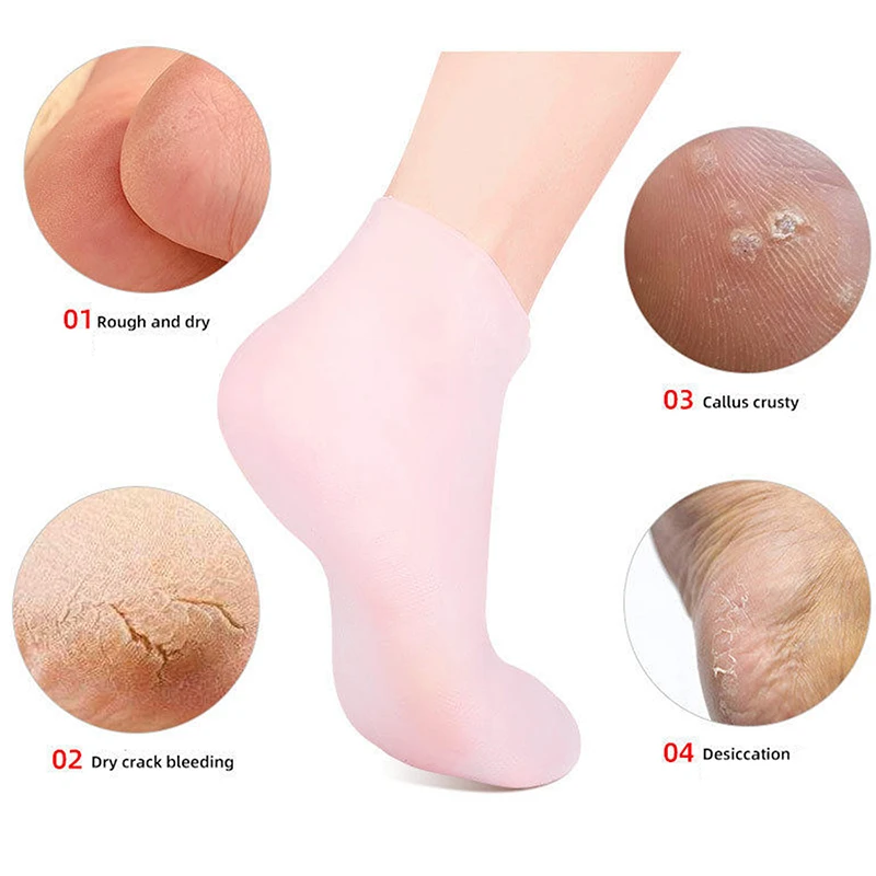 1Pairs Silikon Feuchtigkeitsspendende Fußpflege Socken Anti Füße Haut Trockenheit Rissbildung Peeling Abgestorbene Haut Entfernen Schutz Schmerzen Relief