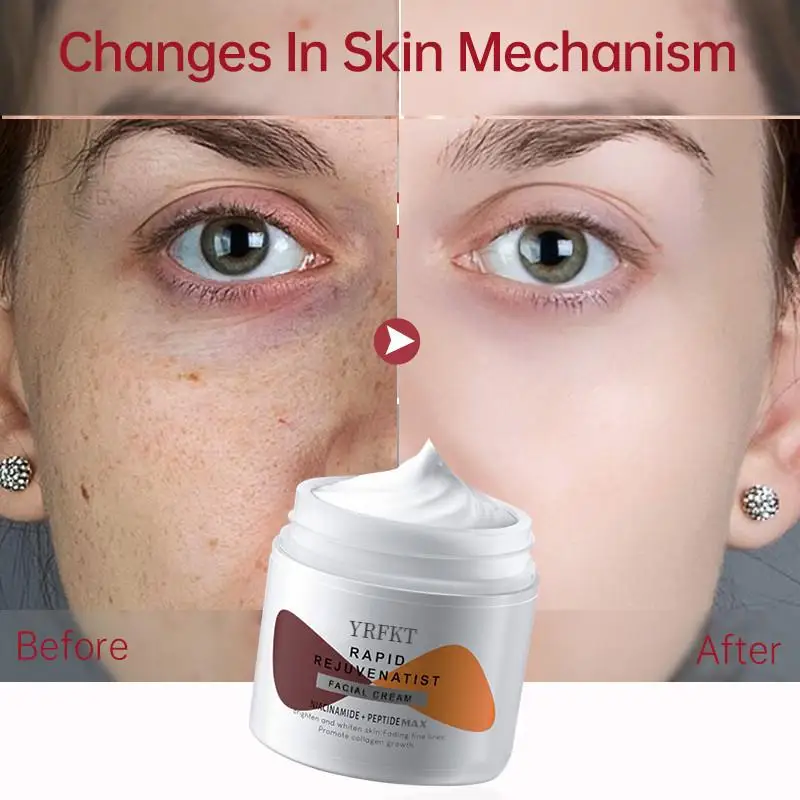 نياسيناميد كريم تبييض النمش العناية بالبشرة المستحلبات الببتيد مكافحة الشيخوخة الوجه التجاعيد كريم بقعة داكنة الميلانين إزالة