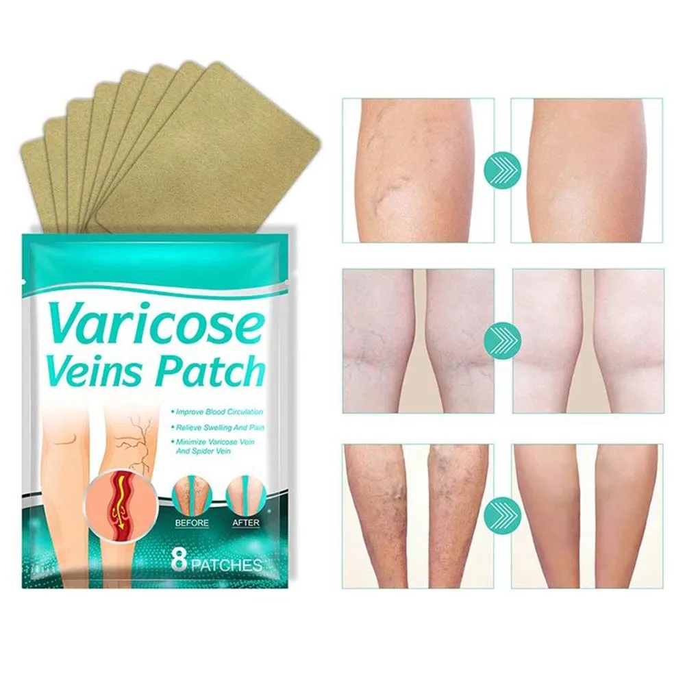 ZK30 Varicose Veins Patch Treatment Promote Smooth Blood Circulation Leg Sore Swelling Plaster Promote Metabolism for Men Women