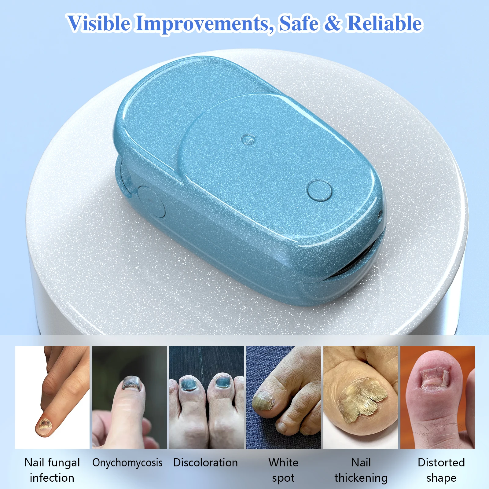 Blue Color Nail Fungus Laser Device 7 Minutes Painless Nail Treatments Device Toenails Onychomycosis Cure Machine 905nm LLLT