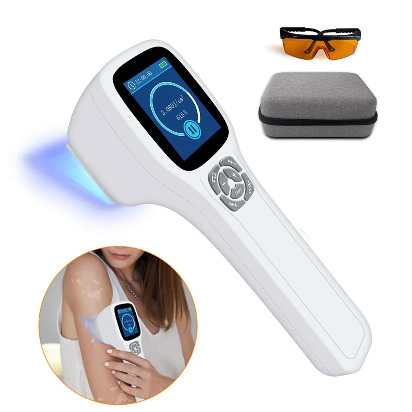 

Portable UVB 308nm Phototherapy Ultraviolet Light Therapy Device Excimer Light Device For Vilitigo Psoriasis Eczema Treatment