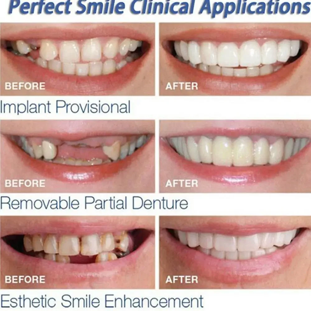 Blanchiment des dents en Silicone, facettes de prothèse dentaire flexible, ajustement parfait, Correction des dents, Simulation du piège dentaire, dents supérieures