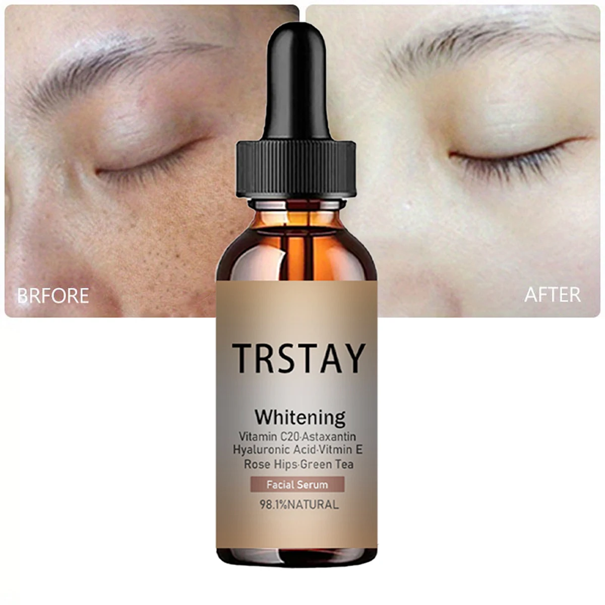 Face Essence essential Oils Anti Wrinkle Anti-aging Lighten Spots Brightening Facial Skin Fade Remove Freckle Speckle Care