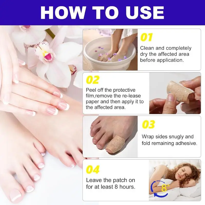 

[WHB]1/5/10/21Pcs Nail Ingrown Correction Stickers Toenail Fungus Patch Nail Repair Patches For Discolored Or Damaged