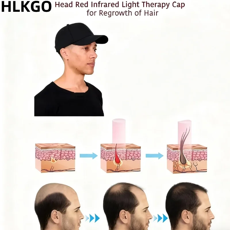 

LLLT Hair Growth Cap with 96 Lasers, Red Light Therapy Device for Scalp Health and Regrowth