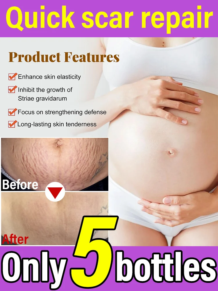 Essential oil line: restore the skin of the stomach, thighs, chest