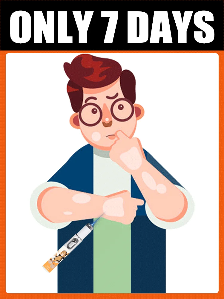 Zegt vaarwel generatie 2 laser in 7 dagen naar Vitiligo