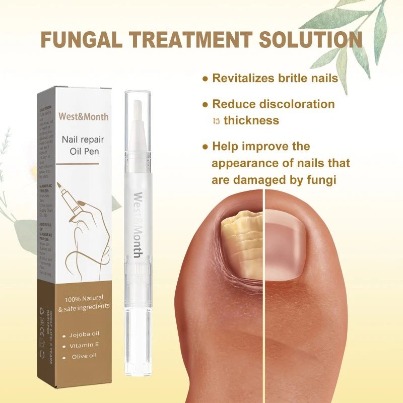 Nail Repair Pen Anti Nail Fungus Infection Foot Paronychia Removal Treatment Onychomycosis Soft Nail Thickening Feet Care Serum