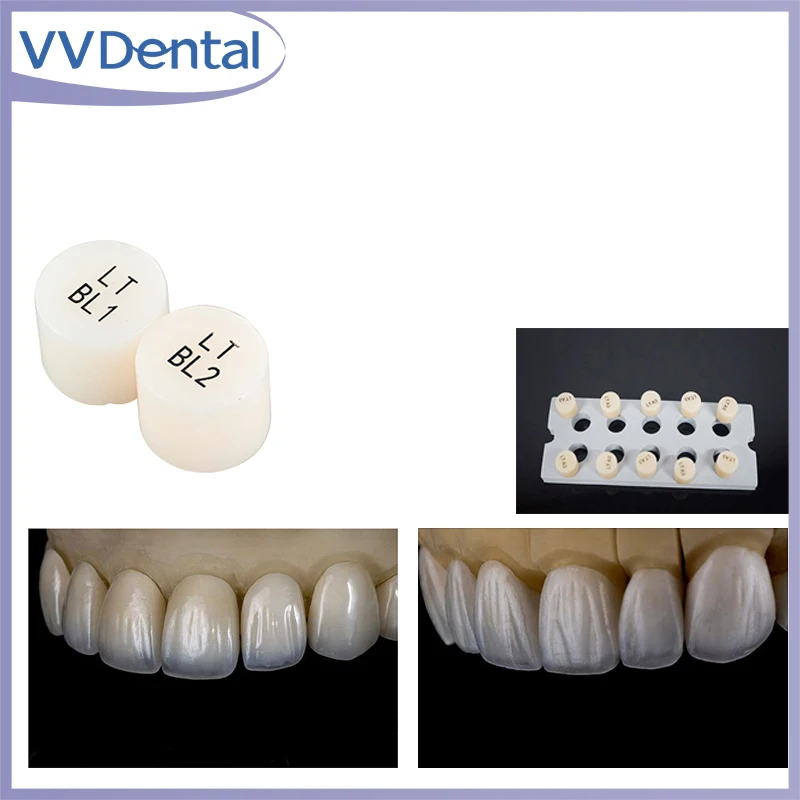 VVDental 10 Pieces Dental Glass Ceramic Ingots Press Blocks Lithium Disilicate Block HT/LT A1-BL3 Dentistry Veneer Material