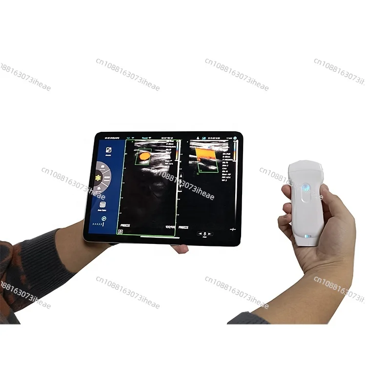 Wireless Wifi Ultrasound Scanner Probe  3 in 1 Color Portable Doppler Handheld Double Head Convex Usg Pocket